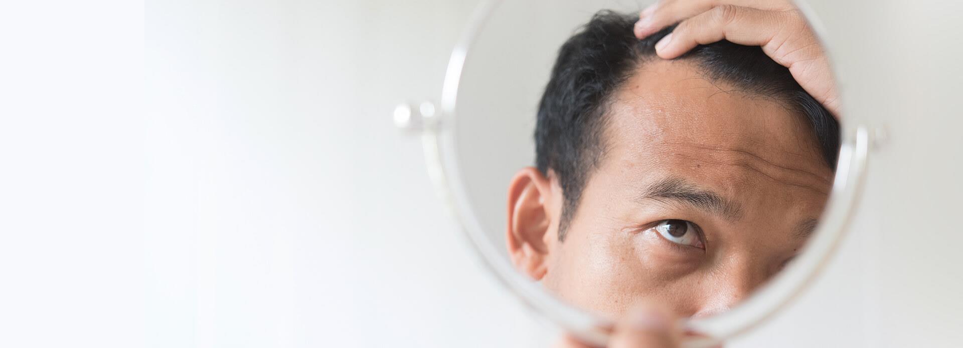 Bespoke Treatments for Hair Loss